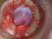 Camera Inside Deep Pussy Captures Huge Ejaculation of Sperm 4k