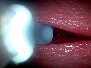 I couldn’t believe what happens INSIDE the penis as sperm passes through &lpar;endoscopic footage&rpar;